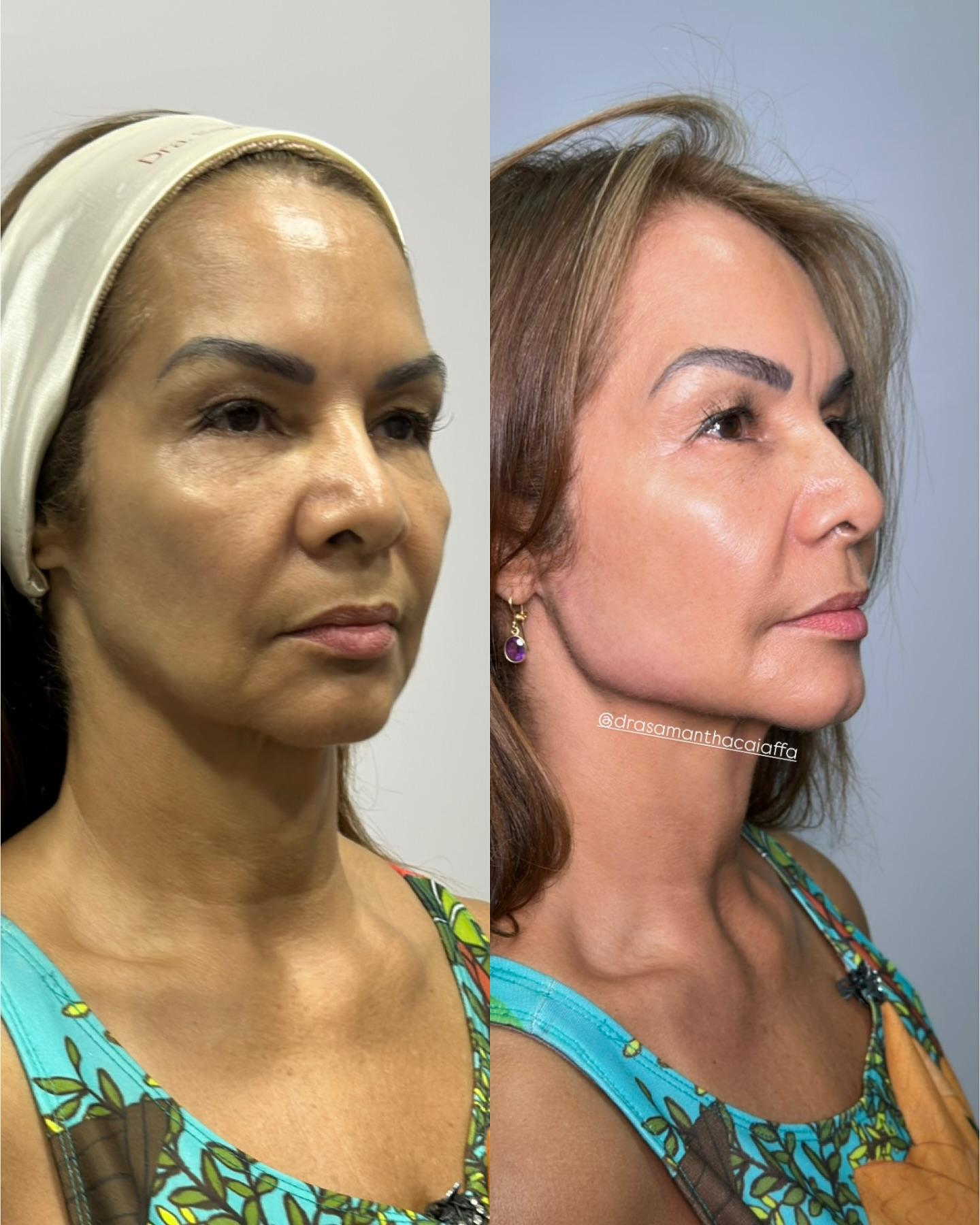 SnapInsta.to_481799717_18491268514024926_1409544927097147110_n