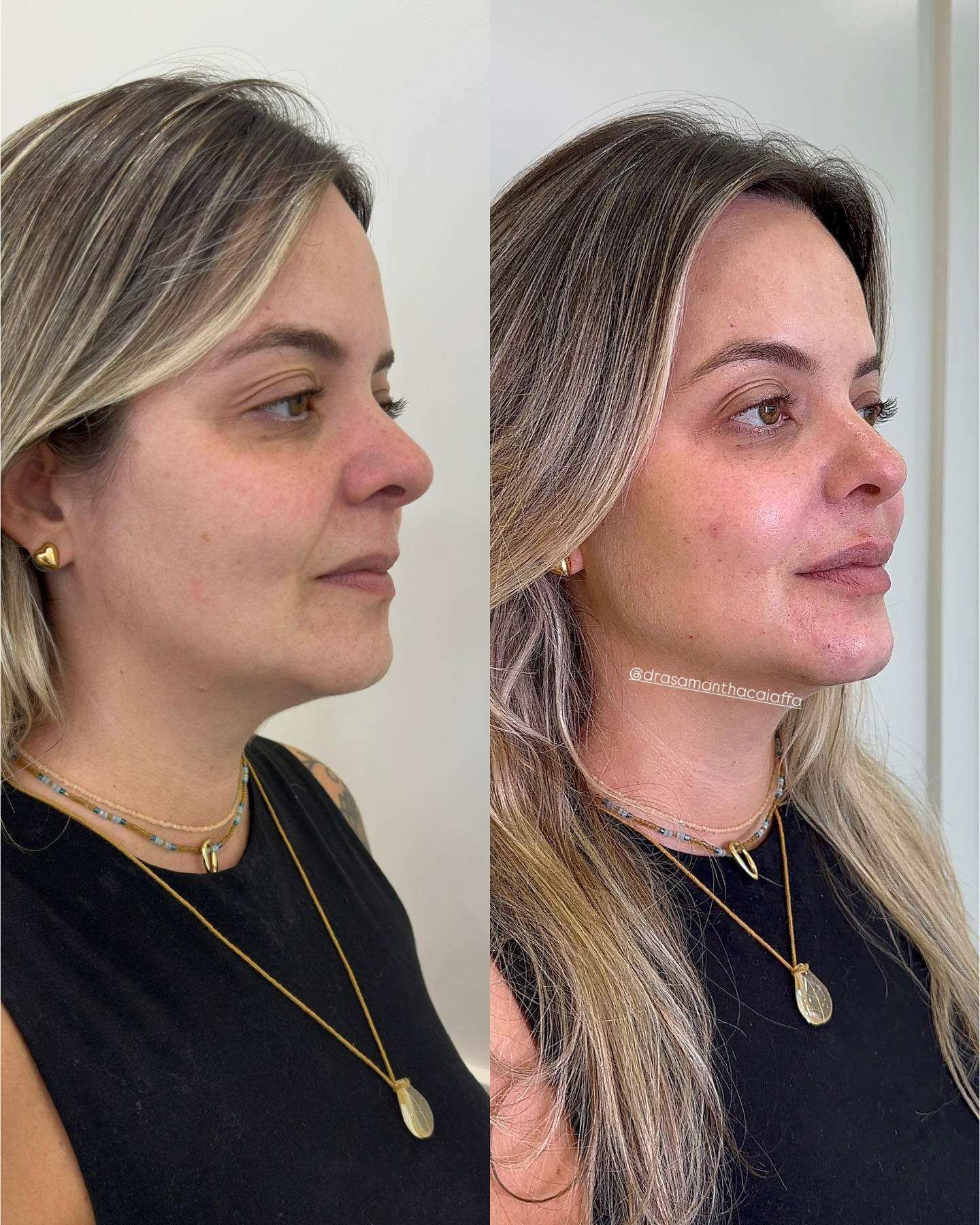 SnapInsta.to_485029043_18495849169024926_8740717164257678450_n