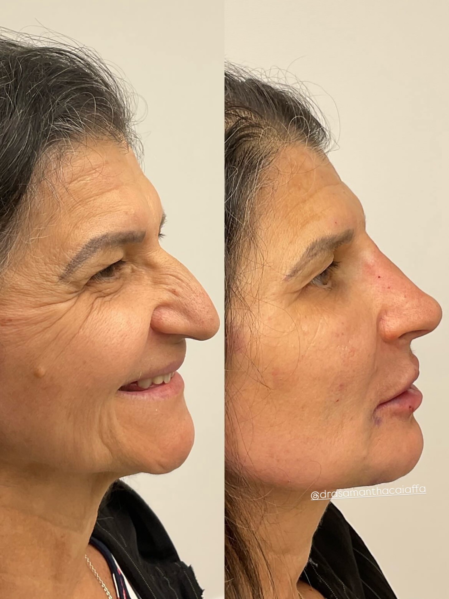 SnapInsta.to_518109101_18518550823024926_6290992467028203396_n