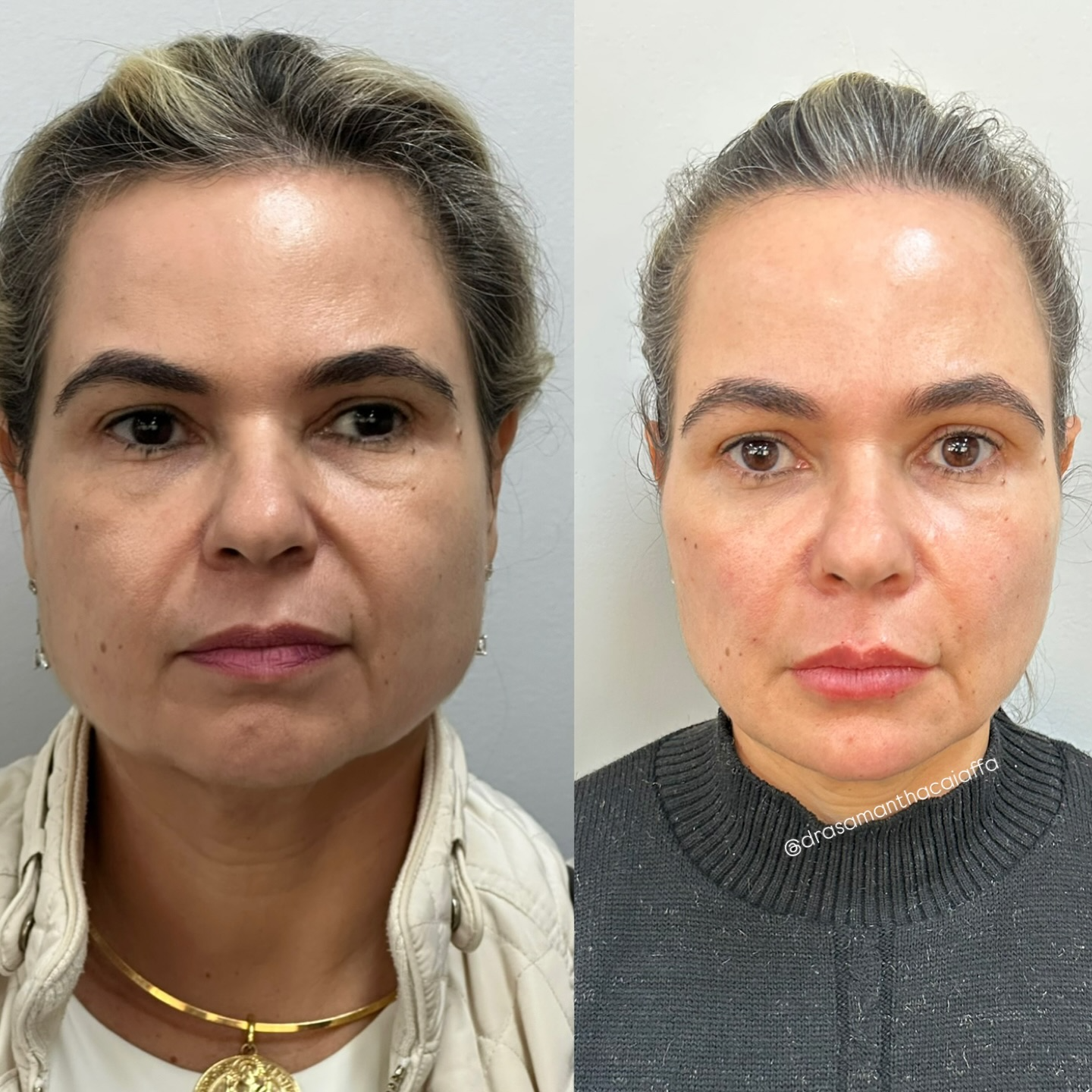 SnapInsta.to_525276030_18520907413024926_7234267719617578344_n