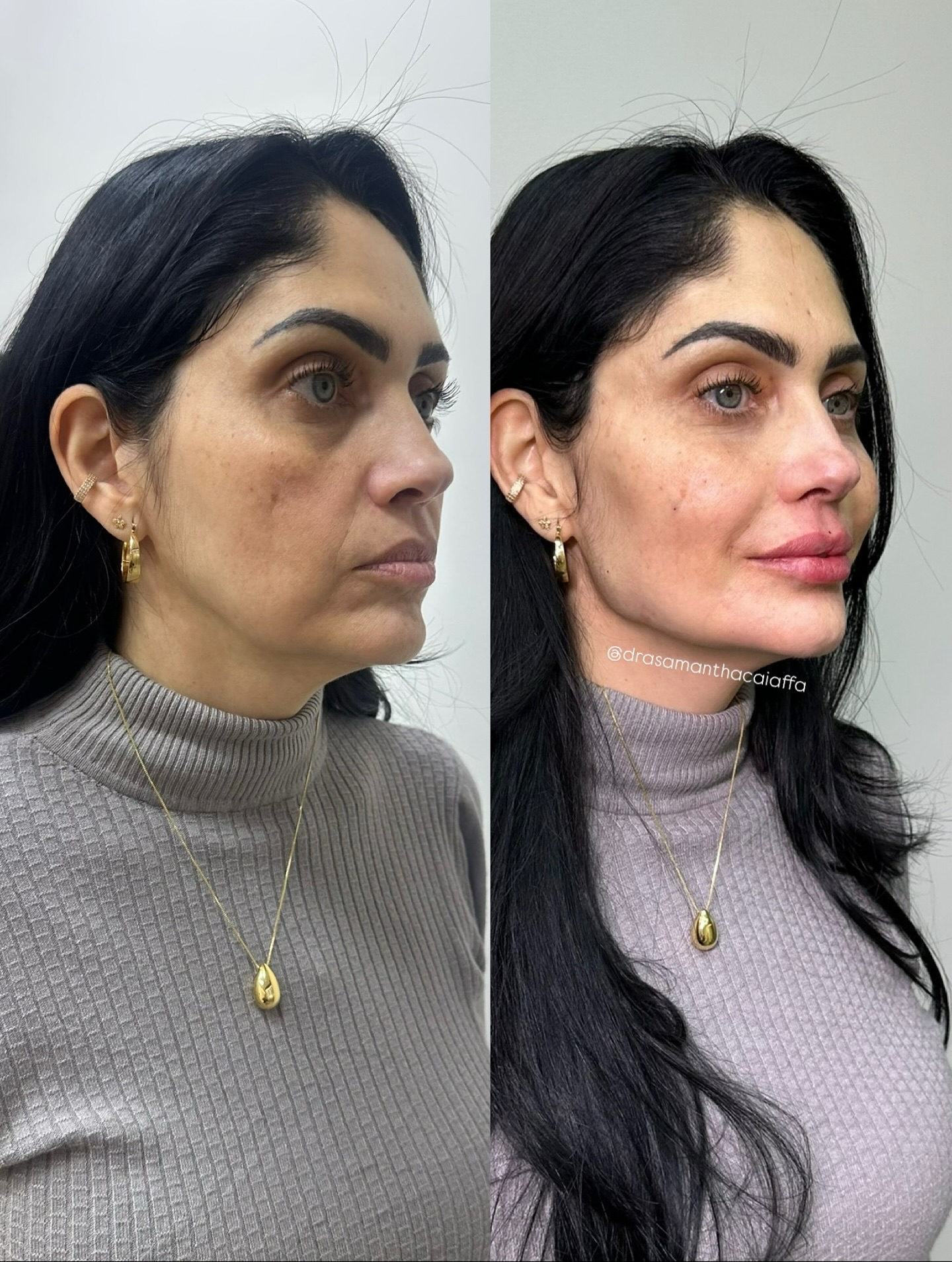 SnapInsta.to_534156797_18524558398024926_7368805078520556316_n