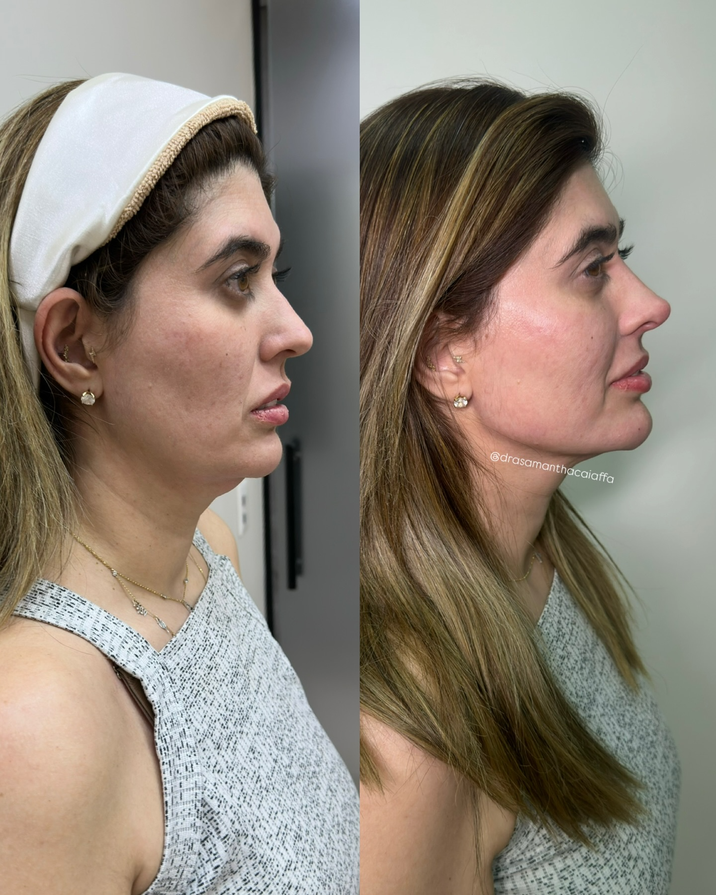 SnapInsta.to_549291342_18530823550024926_1785959354057248228_n